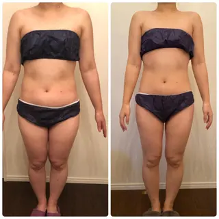 FLEUR大阪・美容 整体・痩身・小顔のエステ・リラクイメージ