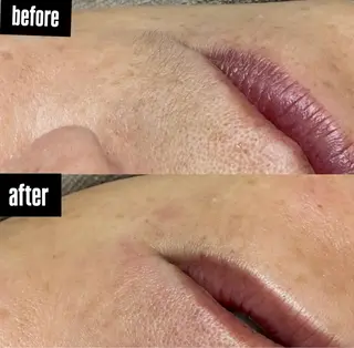 駒月 明日香のネイルデザイン