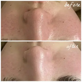 メンズ メナード岐阜茜部 杉浦のエステ・リラクイメージ