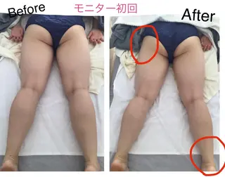 子宮矯正/腸揉み/ シュガーリング脱毛のエステ・リラクイメージ