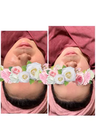 Lien オーナー 山口智嘉のエステ・リラクイメージ