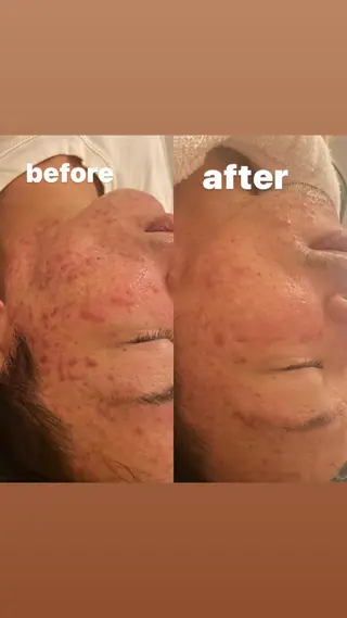 beauty lanaのエステ・リラクイメージ