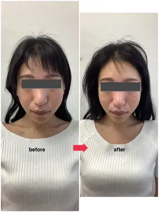 メディカルサロンドオフ所属・ハリサロンドオフ 美容鍼灸×小顔整体のエステ・リラクイメージ