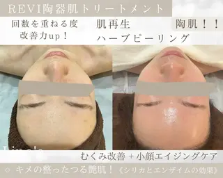 Salon💫 Lino'a柏店のエステ・リラクイメージ