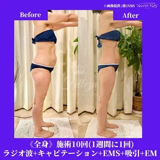 メンズ 有人型セルフサロン 脱毛/痩身/美顔のその他イメージ