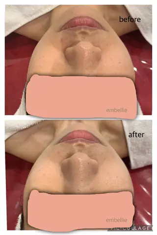 miyasaka erikoのネイルデザイン