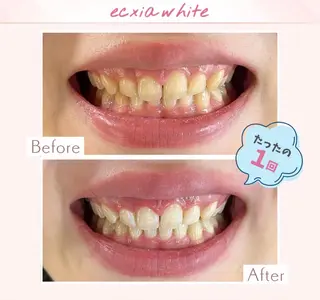 エクシアホワイト調布所属・セルフホワイトニング エクシア調布店のその他イメージ