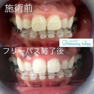 ホワイトニング&アイラッシュ四日市ホワイト所属・アイラッシュ ホワイトニング四日市のマツエク・マツパデザイン