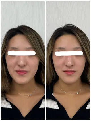 美容鍼×小顔矯正 ×美容整体 浜川泰仁のエステ・リラクイメージ