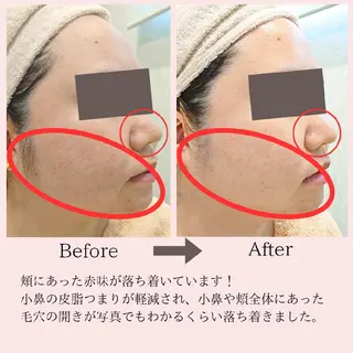 PRETTIEST SHINE所属・山田 浩子のエステ・リラクイメージ