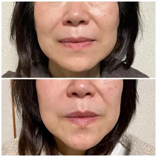 プライベートサロン Lｏｋａｈｉ飯生透のエステ・リラクイメージ