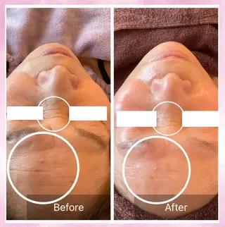 Lumiere despoir所属・Lumiere despoirのエステ・リラクイメージ