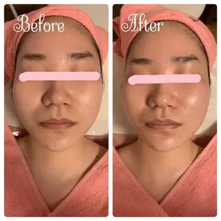 透明感の肌Lino malieのエステ・リラクイメージ