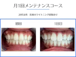 セルフホワイトニング エクシア岡崎店所属・ホワイトニング/脱毛 専門店エクシア岡崎店のその他イメージ