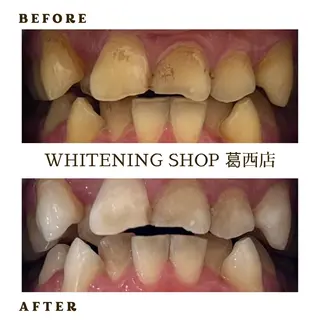 メンズ ホワイトニング ショップ葛西店のその他イメージ