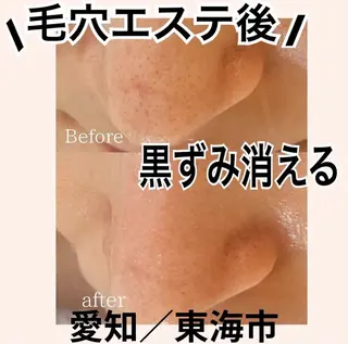 トータルビューティー サロンLilyのエステ・リラクイメージ