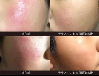 山元 光絵のエステ・リラクイメージ