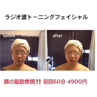 小尻・太もも痩せる エステルナボーテのエステ・リラクイメージ