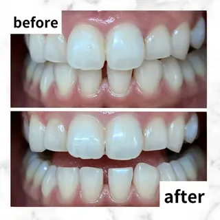 LBSホワイトニング 🌐渋谷店 河内のエステ・リラクイメージ