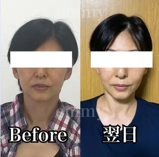 小顔と ヘッドスパのお店のエステ・リラクイメージ