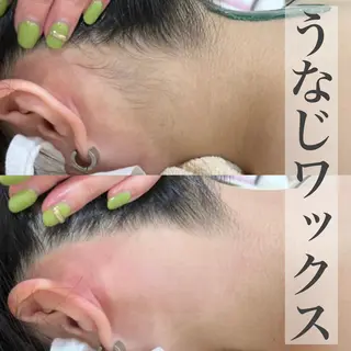 フェイシャル/脱毛 ジョアアンジェ さきのエステ・リラクイメージ