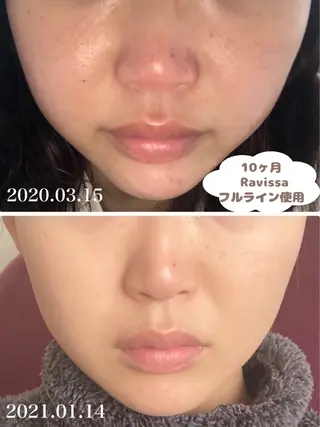 Prima栄店所属・Prima 〜プリマ栄店〜のエステ・リラクイメージ