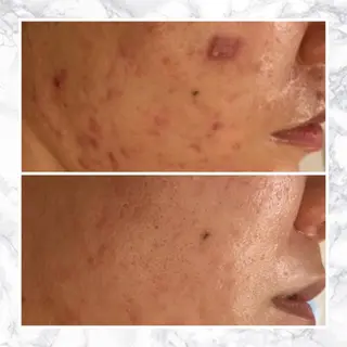 ショート カラー パーマ ヘアアレンジ メンズ キッズ ネイル マツエク・マツパ アイブロウ 触れたくなる モテ肌へ...❤︎のエステ・リラクイメージ