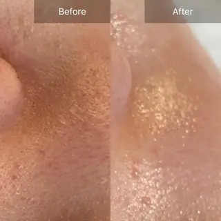 Mandarin Orange所属・毛穴から始める肌メン テマンダリンオレンジのエステ・リラクイメージ