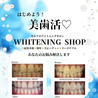 メンズ ホワイトニングショップ静岡葵区店所属・ホワイトニング ショップ静岡葵区店のその他イメージ