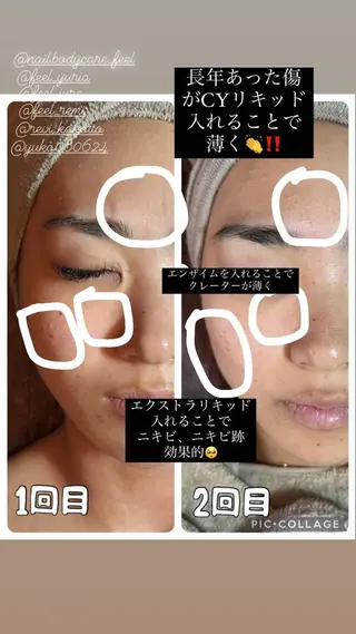 エステ✖️ネイル Feelのネイルデザイン