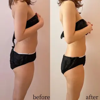 アンテインチル 山本のエステ・リラクイメージ