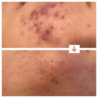 たるみ改善小顔エステ 堀葉月のその他イメージ