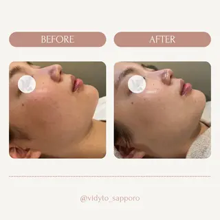 【vidyto】ヴィディトゥ所属・肌管理サロン vidyto MOEのエステ・リラクイメージ