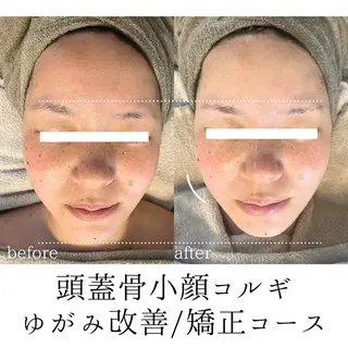 頭蓋骨小顔コルギPerm所属・頭蓋骨小顔コルギ Permのその他イメージ