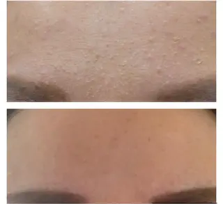 癒し腸もみサロン シャユーム　ゆきなのエステ・リラクイメージ