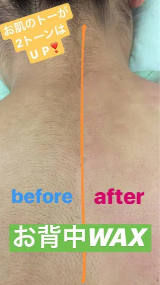 毛穴レス ハーブ& ワックス脱毛×光脱毛のエステ・リラクイメージ