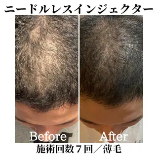 トータルビューティー サロンSalaのマツエク・マツパデザイン