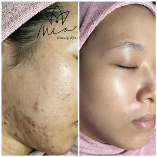 Mia beauty所属・MiA Beautyのエステ・リラクイメージ