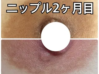 小顔専門看護師クリニカルサロンCOCO所属・ローマピンクと小顔 クリニカルサロンココのエステ・リラクイメージ