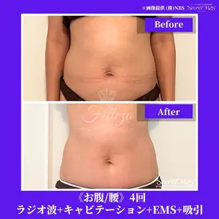 メンズ 有人型セルフサロン 脱毛/痩身/美顔のその他イメージ