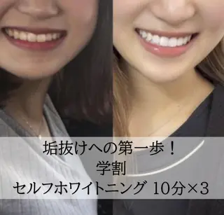 ホワイトニング専門店 LCS 新橋店 佐藤のその他イメージ