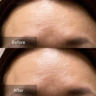 産毛専門店 Bittoのエステ・リラクイメージ