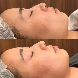 Hari Lounge恵比寿所属・chika🦋 ハリラウンジ恵比寿のエステ・リラクイメージ