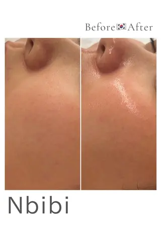 韓国🇰🇷価格 サロン_Nbibiのエステ・リラクイメージ