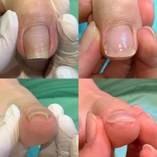 ネイル 東京巻き爪アカデミー所属・東京巻き爪 アカデミーのエステ・リラクイメージ