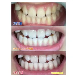 MBEAUTYSALON 千葉店・京成大久保所属・Melty 輝のその他イメージ