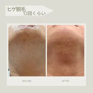 Syl.所属・Syl. シールのエステ・リラクイメージ
