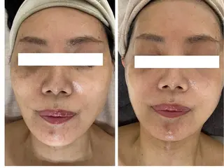 Total Beauty salon Bloom所属・肌育WISHpro 専門サロンBloomのエステ・リラクイメージ