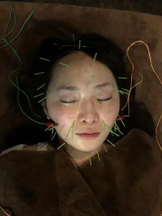 美容鍼灸サロン LOMIHARIのエステ・リラクイメージ