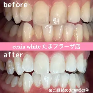 セルフホワイトニング　エクシアたまプラーザ店所属・セルフホワイトニング エクシアたまプラーザのその他イメージ